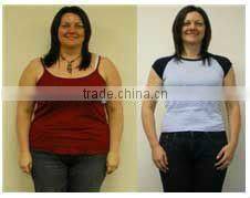 Vacuum/Optical fiber/Ultrasonic Slimming Equipment/Body Shaping Machine (FB-F002)