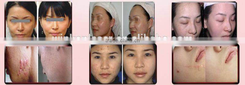 facial firming machine / medical beauty equipment