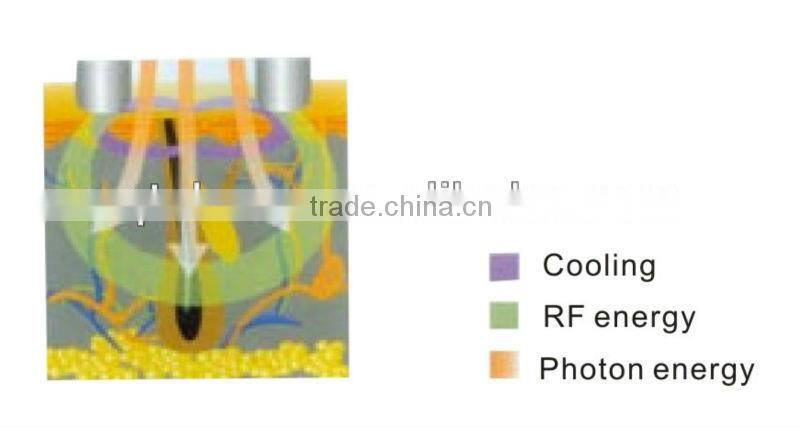 IPL+RF E-light professional beauty machine to remove hair wrinkle freckles