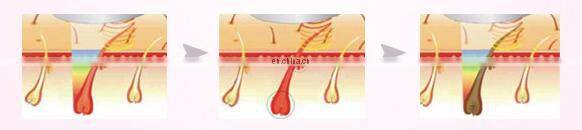 DEESS 3 in 1 with effect replaceable lamps device ipl hair removal beauty product