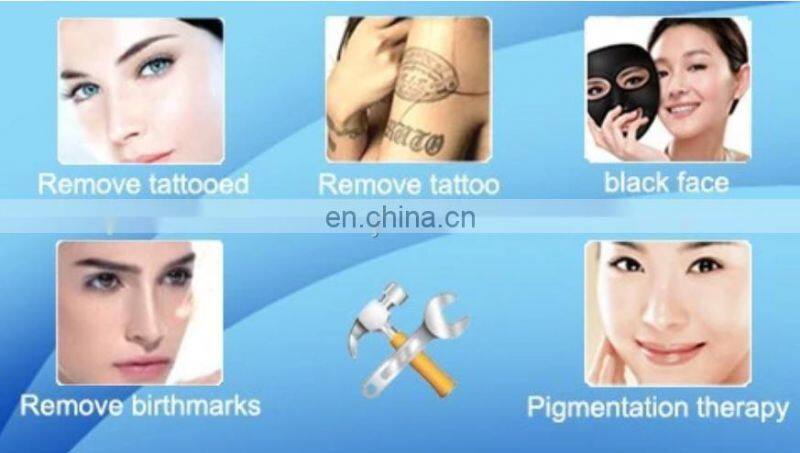 Sales 2000mj 532nm 1064nm 755nm  pico laser tattoos remover Q-switched nd yag laser tattoo removal machine price for spa use
