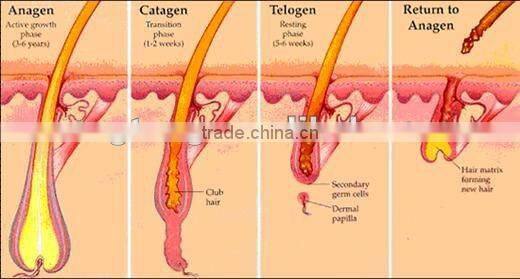 FDA elight ipl hair removal machine med-230