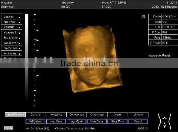 2015 new laptop ultrasound scanner (PC system) on Sale
