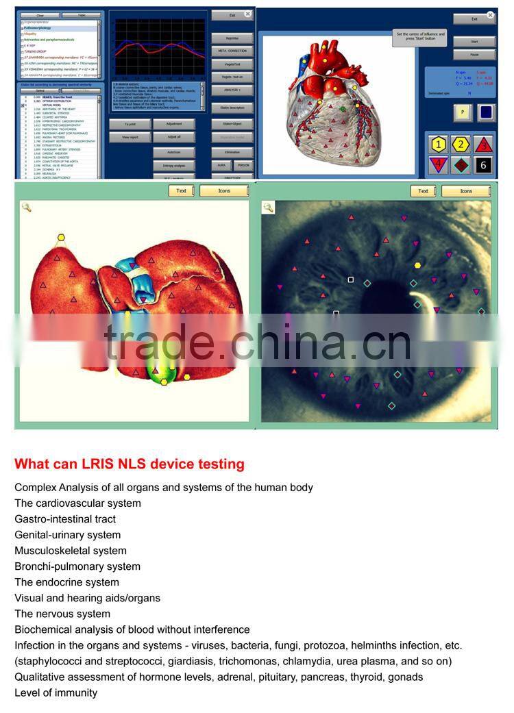 8D LRIS NLS Intelligent healthy diagnostic system 8D LRIS-NLS composition analyze equipment