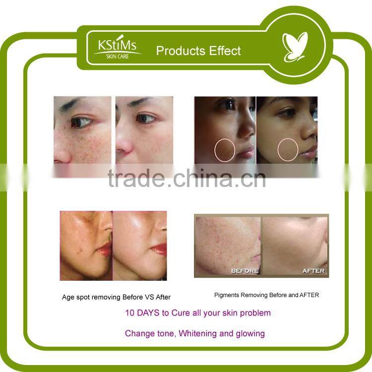 No side effect Instant Forever glutathione Anti spot best black skin face whitening beauty cream