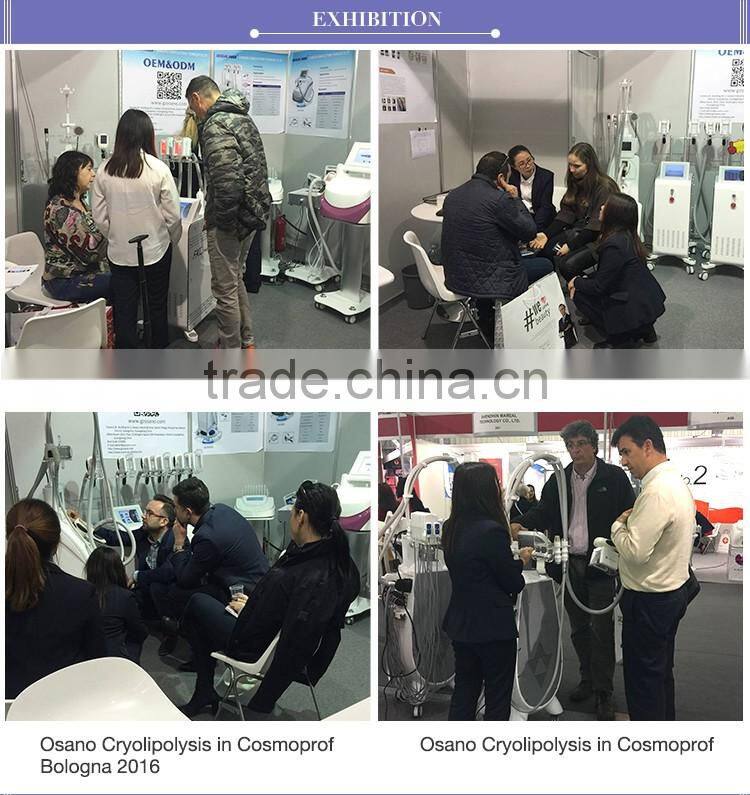 Criolipolise slimming / Criolipolisis slimming machine / Criolipolisys fat freezing cryolipolysis