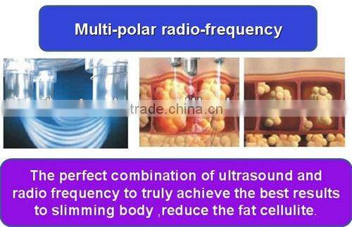 Multifunctional weight loss machine with ipl rf laser