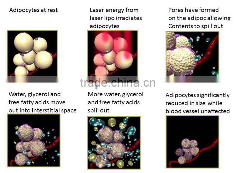New products looking for distributor! 528 Diodes lipoLaser / Lipo Laser Machine/ Lipo Laser Slimming Machine