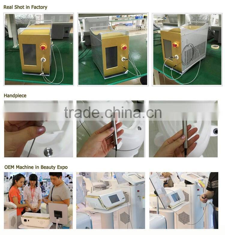 OD-H980 Portable 980nm laser spider vein removal