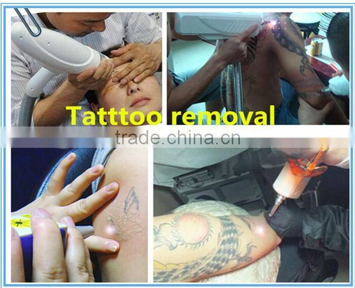 Professional Q switch nd yag tattoo removal laser