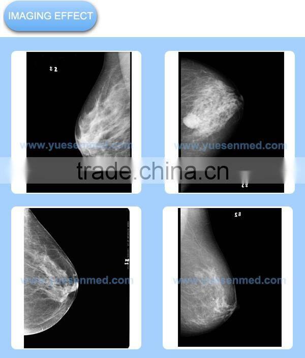high frequency fixed or rotating anode cheapest mammography x ray price
