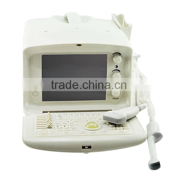 1 USB factory price OEM design 80 elements R60 ultrasound scanner for pregnancy
