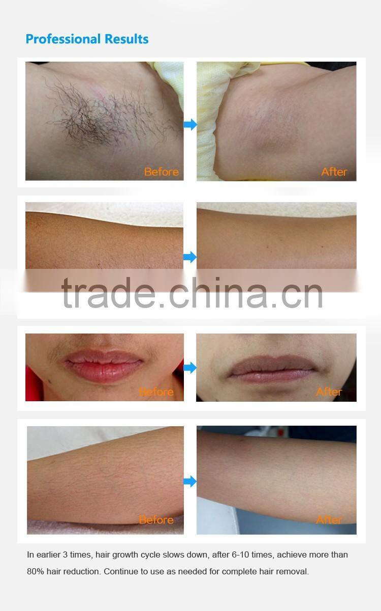 GSD manufacturer DEESS hair removal waxing machine for painless hair removal
