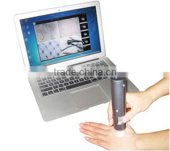 Portable WIFI facial and hair scanner analyzer diagnosis