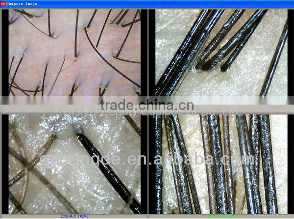 High Resolution Analysis Beauty Equipment for Skin and Hair beauty machine BD-P019