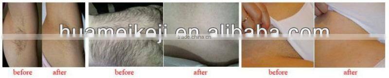 diode laser hair removal beauty machine EROSE-YB6