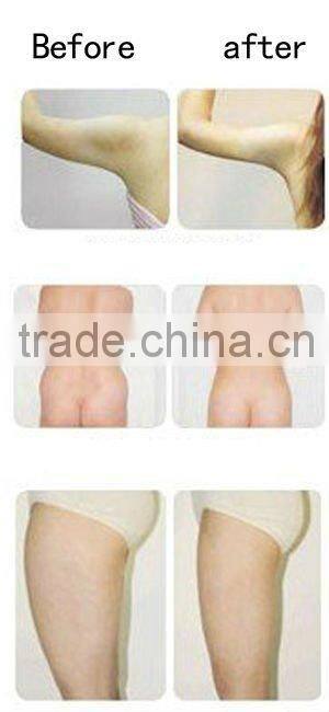 Hot sale !Beauty Equipment Ultrasonic Liposuction Slimming Equipment