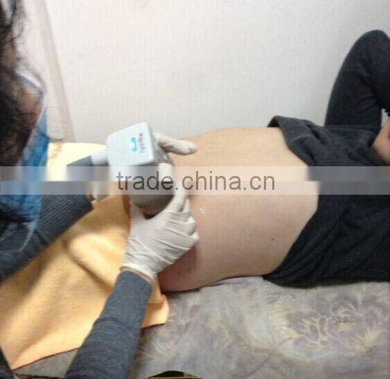 Quickly Body Fat Slimming Lipohifu 13mm for Fat Removal