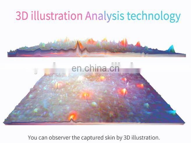 Newest Multi-languages Auto-analysis 10 Mega Pixels Beauty Skin Moisture Analyzer