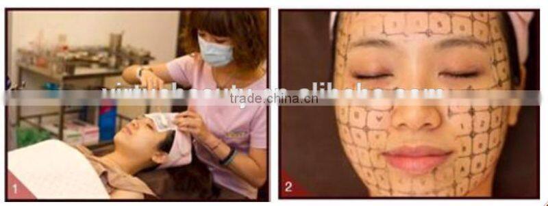 SHR LASER HAIR REMOVAL FOR BEAUTY SALON