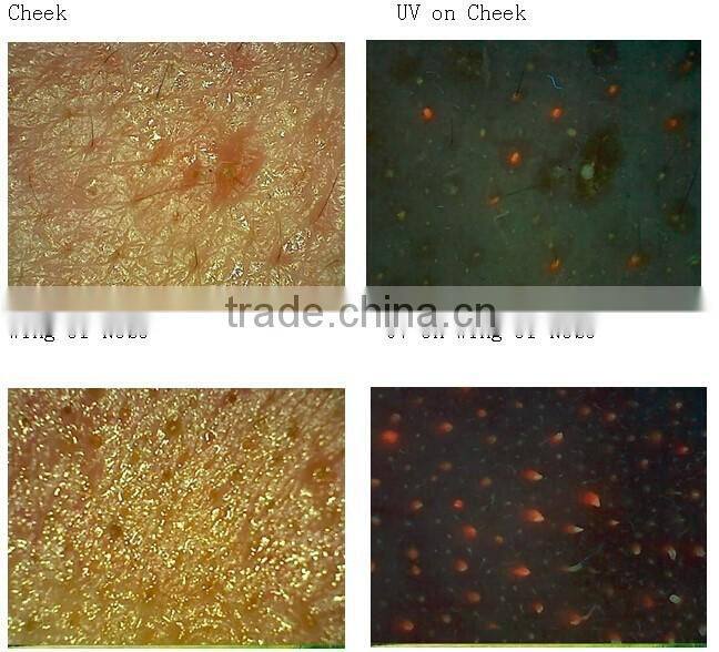 AYJ-J016 beauty salon equipment Portable Intelligent Digital Skin Analyzer 3d