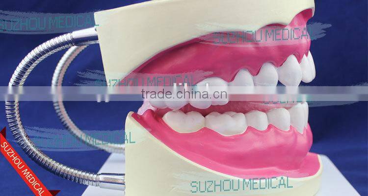 Teeth care model