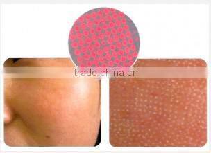 30W RF Tube Co2 Fractional Laser for Acne Skin Care