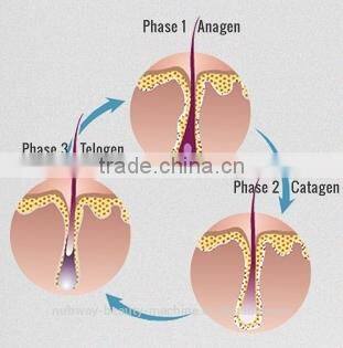 Nubway 2015 New 10.4 Inch Screen Keyword 810nm Diode Laser Hair Removal Machine