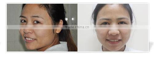 mesotherapy gun skin whitening facial care mesogun injector