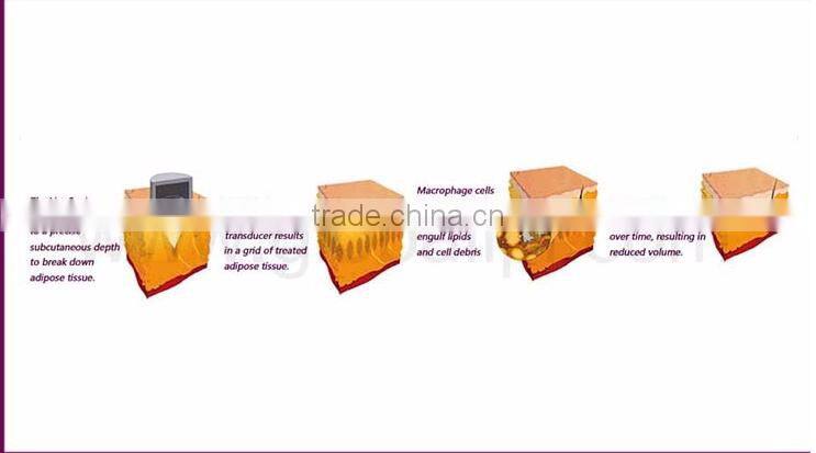 ce approval hifushape liposonic body slimming machine wholesale price