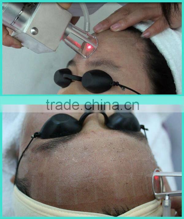 Newest CO2 laser machine laser co2 fractional,fractional co2 laser equipment,co2 laser