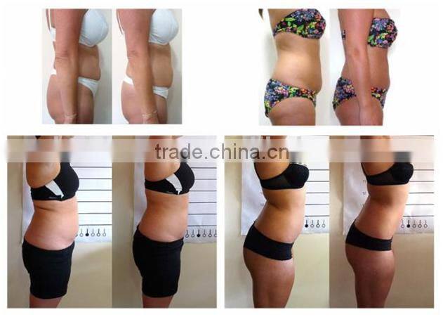 4 Wavelengthes Mitsubishi Diode / 528 diodes Lipo Laser CE Approved/Body Slimming