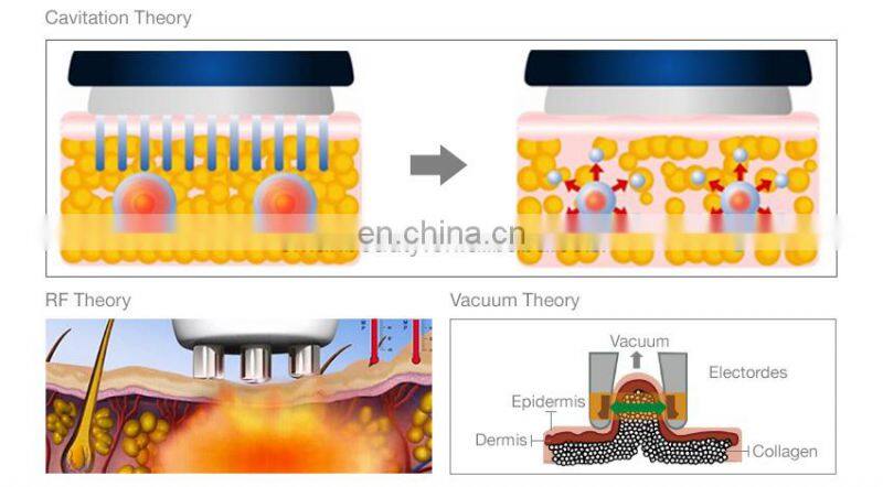 Sales Professional Ultrasound Cavitation RF cavitation slimming machine weight loss Fat Removal