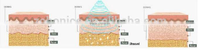 BZ06 5 in 1 ultrasonic vacuum cavitation RF BIO slimming machine