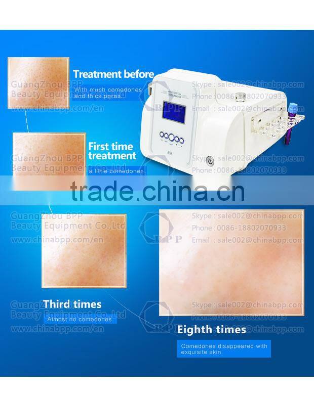 BIO OXY SKIN Pure Oxygen/High Bar Pressure,/Design & Natural Cosmetics/Machine Water Oxygen Jet Peel