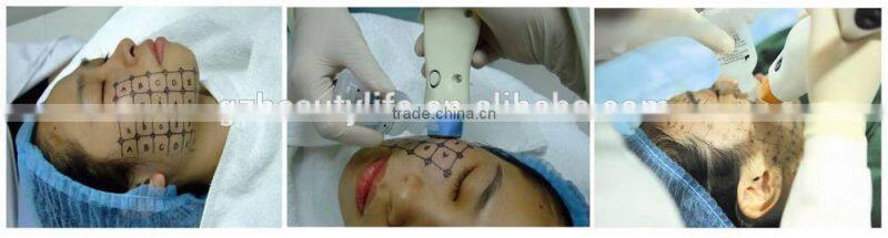 Micro needle RF fractional machine