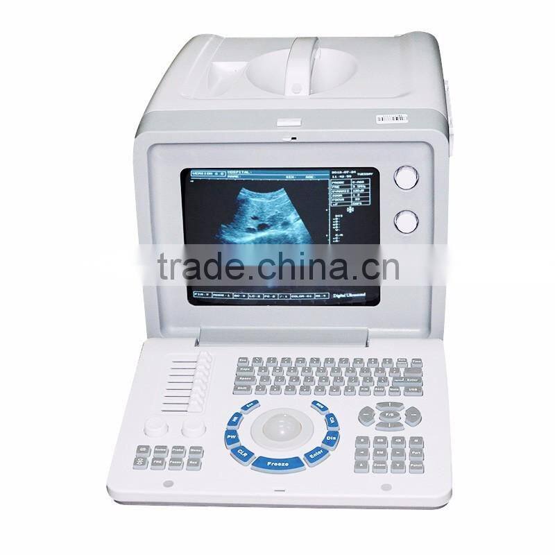 CE Approved full digital LCD display diagnostic laptop ultrasound scanner