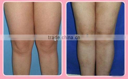 Ultrasonic Cavitation System Fat Loss Machine on sale (FB-F017)