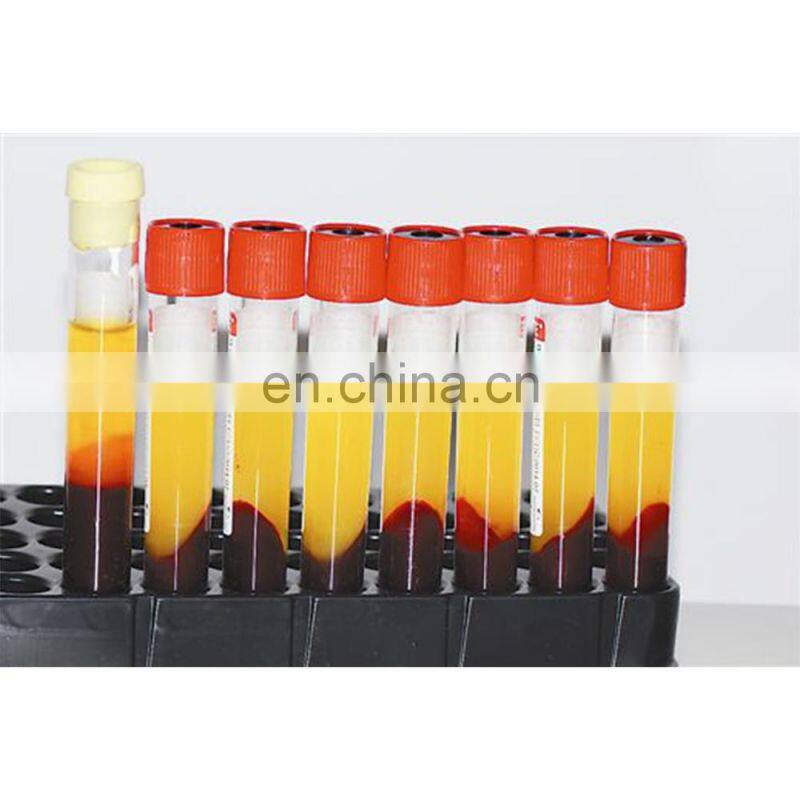 TD4A-WS Benchtop Low-speed PRP &PRF & CGF centrifuge machine