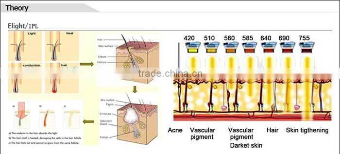e-light RF IPL machine/ Laser ipl rf machine/ e-light rf beauty machine
