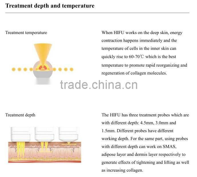 Hot new product portable ultrasound hifu wrinkle removal system / machine hifu