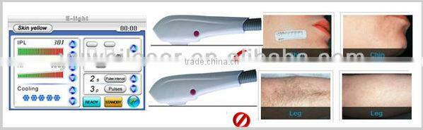 stationary beauty equipment