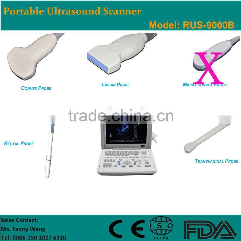 Factory price!CE approved Notebook B-Mode Ultrasound Scanner with 7.5Mhz multi-frequency linear probe RUS-9000B