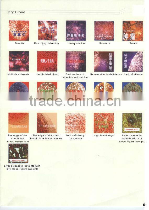 Blood Analyzing Video Microscope in dark Field