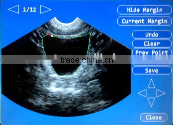 CareScan-1 Bladder Scanner Diagonosis Portable Scanner