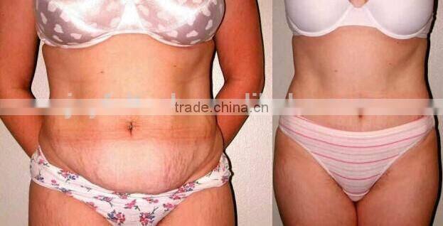 JF-800 weight loss beauty apparatus with vacuum massage