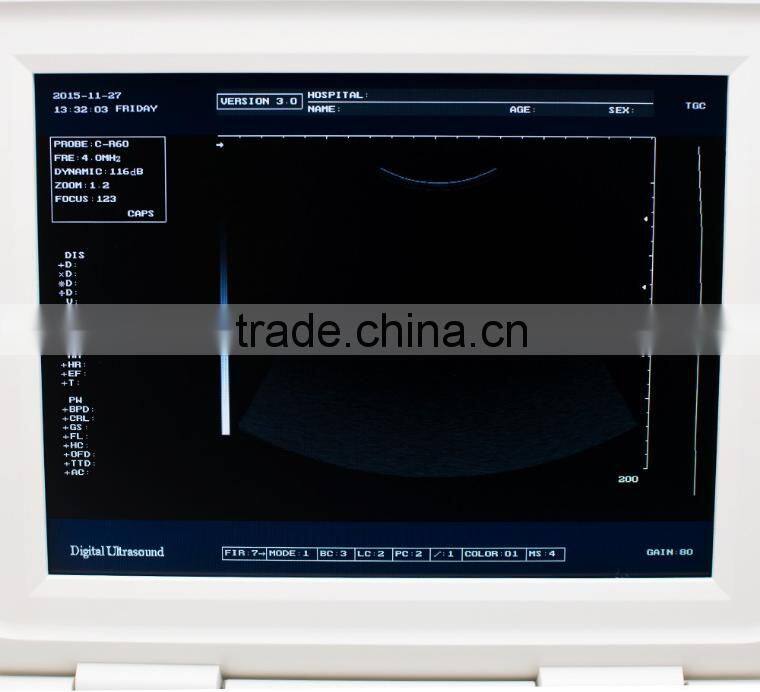 OEM factory 10.4 inch TFT color LCD laptop portable ultrasound machine for pregnancy