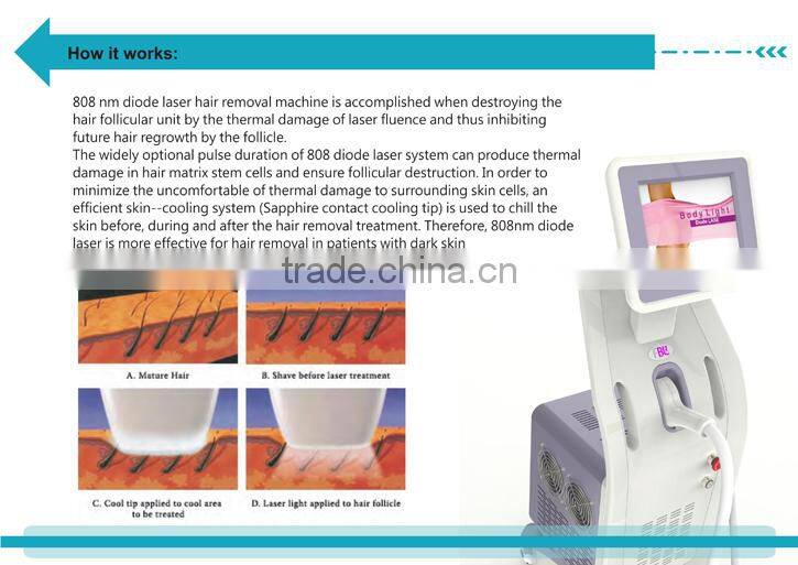 New 808nm diode laser hair removal