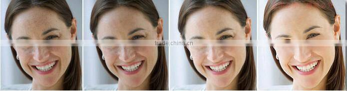 skin rejuvenation derma pen for sale