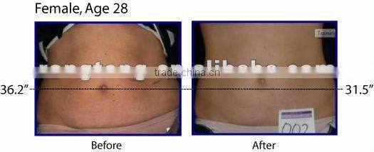 Promote tissue metabolism MED-360